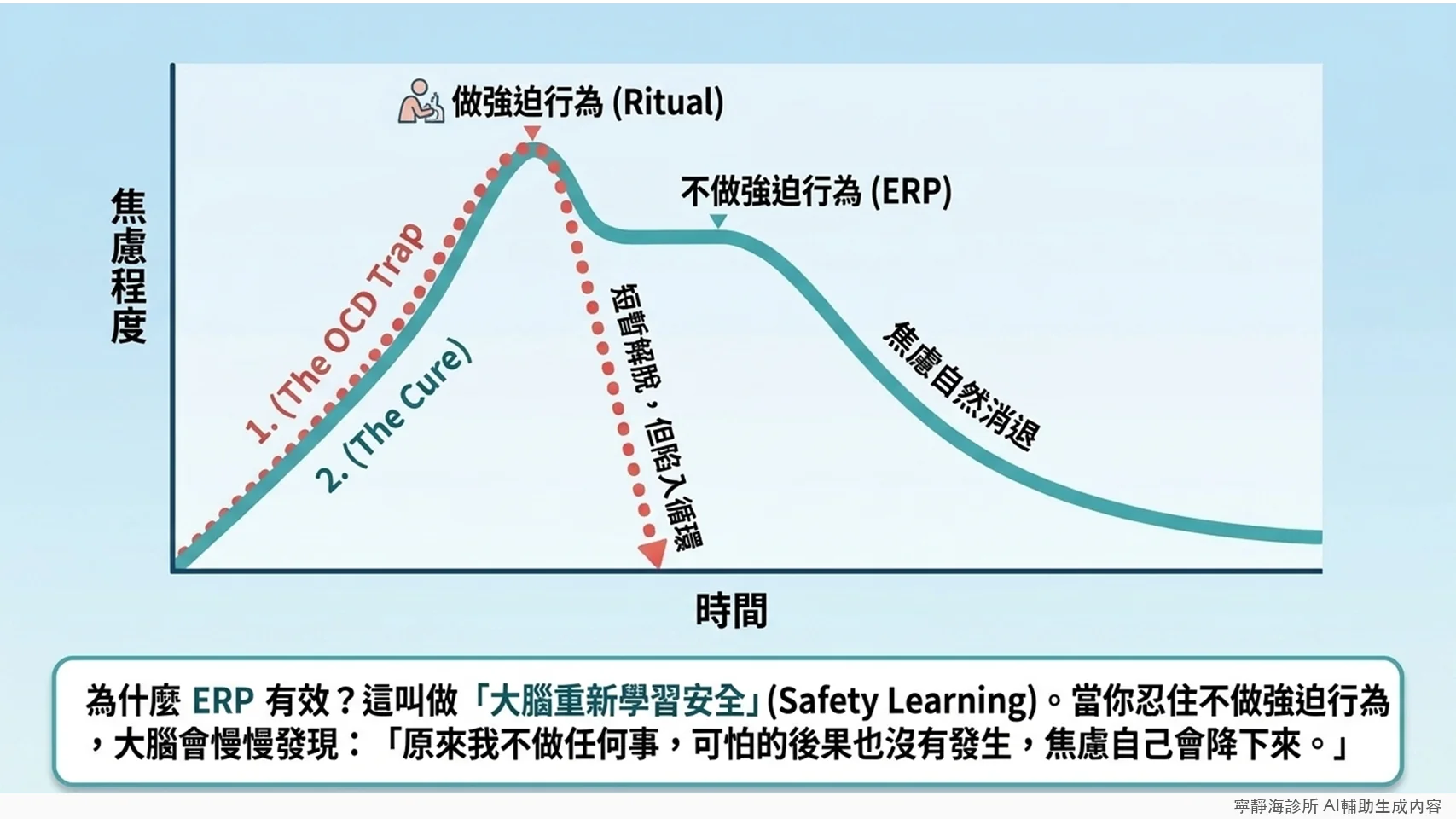 ERP治療焦慮曲線:不做強迫行為焦慮自然消退,做強迫行為只是短暫解脫又陷入循環